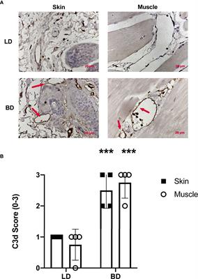 In Situ Pre-Treatment of Vascularized Composite Allografts With a Targeted Complement Inhibitor Protects Against Brain Death and Ischemia Reperfusion Induced Injuries